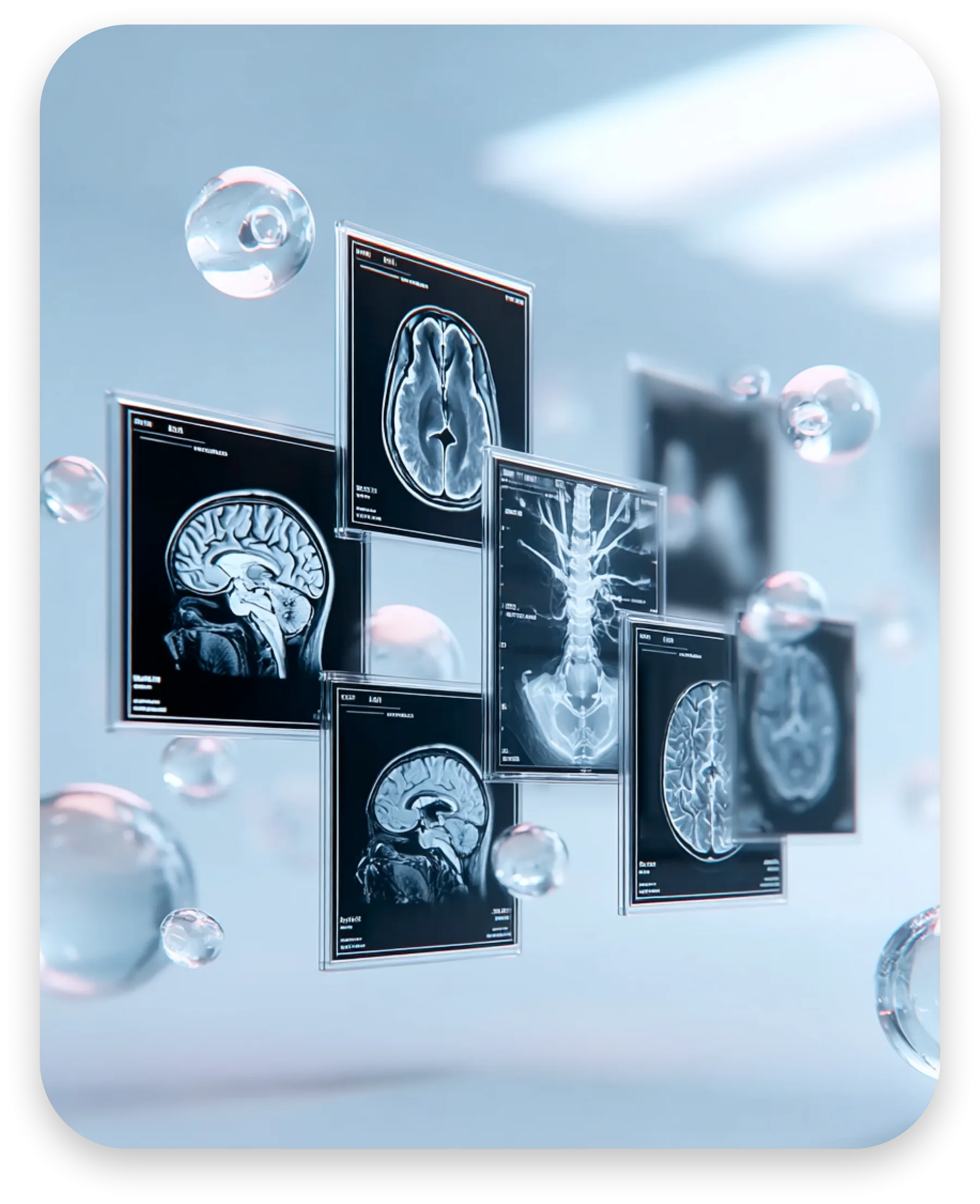 AI project